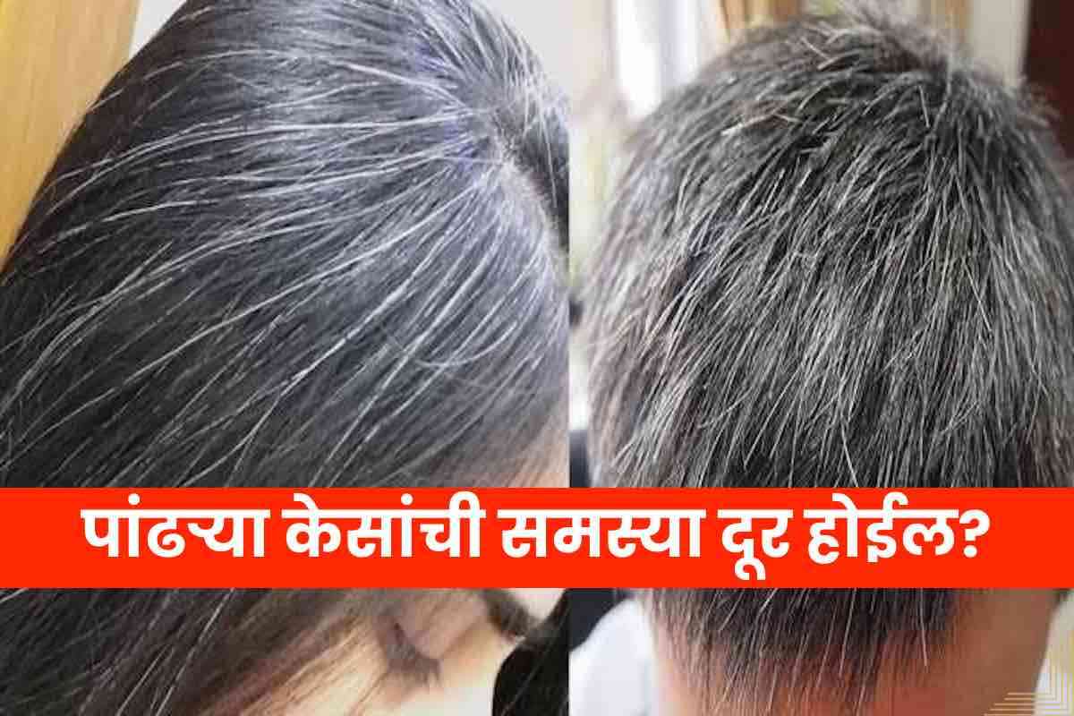 White Hair Remedies News: White Hair Remedies in Marathi, Photos, Latest  News Headlines about White Hair Remedies Marathi Gold
