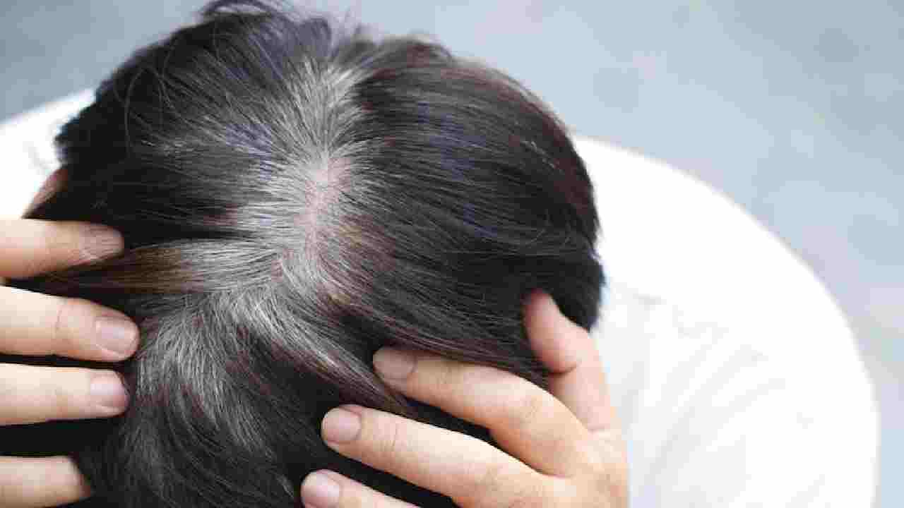 white hair home remedies